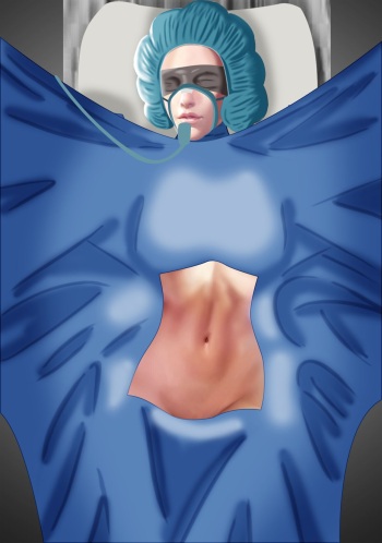 Arena Of Valor: Lauriel abs only cover